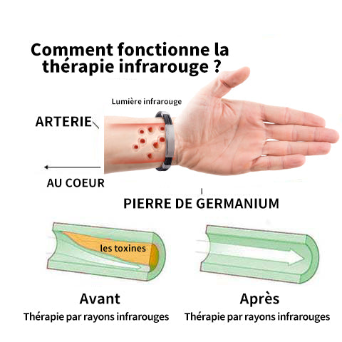 𝐉𝐎𝐒𝐅𝐈𝐓™🌱Titanový detoxikační lymfatický náramek