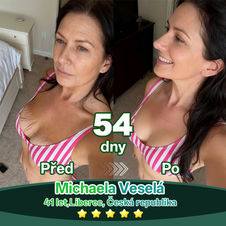 Lékárna Na Poště | Lotmay® Kapky s kmenovými buňkami a kolagenovými peptidy pro vnitřní použití👩‍⚕️ (Zpevnění a lifting povolené pokožky & redukce tvorby vrásek)