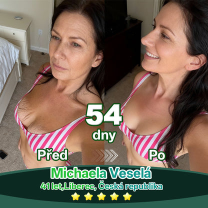 Lékárna Na Poště | Lotmay® Kapky s kmenovými buňkami a kolagenovými peptidy pro vnitřní použití👩‍⚕️ (Zpevnění a lifting povolené pokožky & redukce tvorby vrásek)