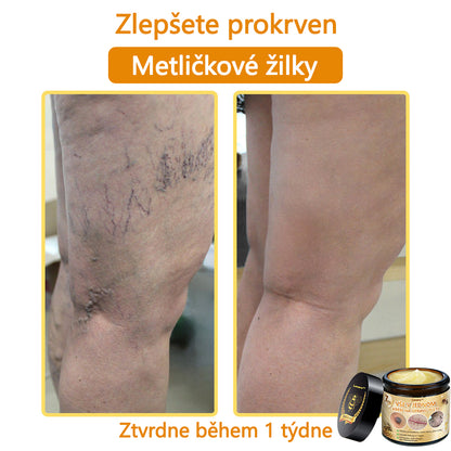 🎇𝐋𝐞𝐧𝐚𝐫𝐨™ Včelí jed všestranný krém, schválený českými dermatology (👩‍ Doporučeno Českou společností pro kožní a pohlavní nemoci CGDV)