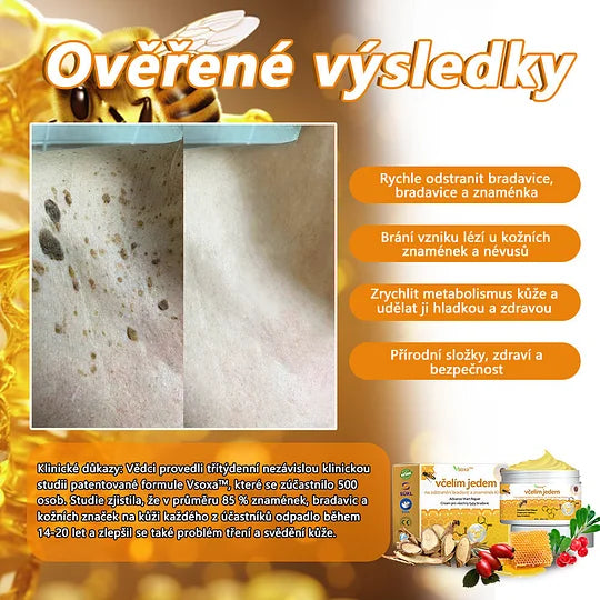 💥🔥𝐕o𝐬𝐨𝐱𝐚™ 𝐕č𝐞𝐥í𝐦 𝐉𝐞𝐝𝐞𝐦 𝐍𝐚 𝐎𝐝𝐬𝐭𝐫𝐚𝐧ě𝐧í 𝐁𝐫𝐚𝐝𝐚𝐯𝐢𝐜 𝐀 𝐙𝐧𝐚𝐦é𝐧𝐞𝐤 𝐊𝐫é𝐦🐝🐝(🔥𝐏𝐫𝐨𝐩𝐚𝐠𝐚č𝐧í 𝐚𝐤𝐜𝐞 𝐧𝐚 𝐩𝐨𝐬𝐥𝐞𝐝𝐧í 𝐝𝐞𝐧 𝟖𝟎% 𝐬𝐥𝐞𝐯𝐚)🔥💥✨