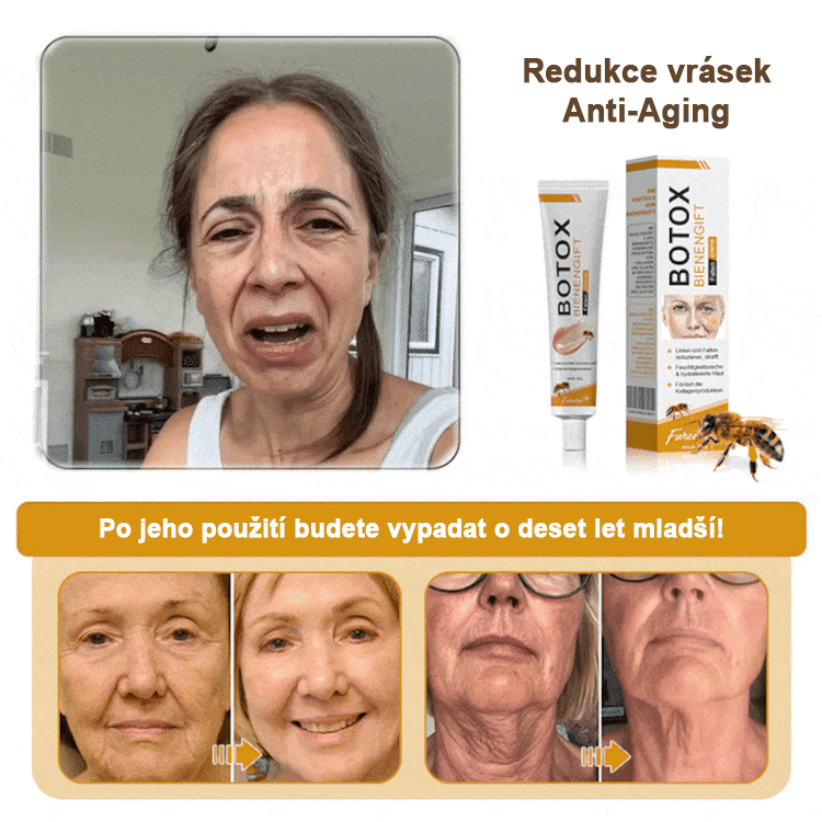 (💟Vyrobeno a odesláno z České republiky✅) Furzero™ Botox včelí jed krém na odstranění vrásek - POSLEDNÍ DEN 70% SLEVA