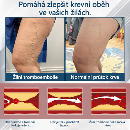 Cvreoz® Černý kmín Edema Detoxikační bylinný krém