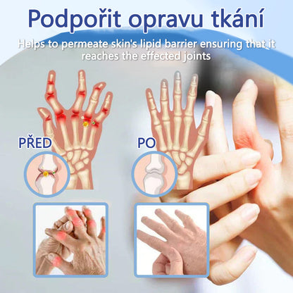 ✅ Schváleno MZČR lékaři | Ourlyard® Hořčíkový krém na úlevu od bolesti kostí a svalů ( Pro artritidu, neuropatii, revmatická onemocnění, svalové křeče, záškuby i sportovní úrazy)