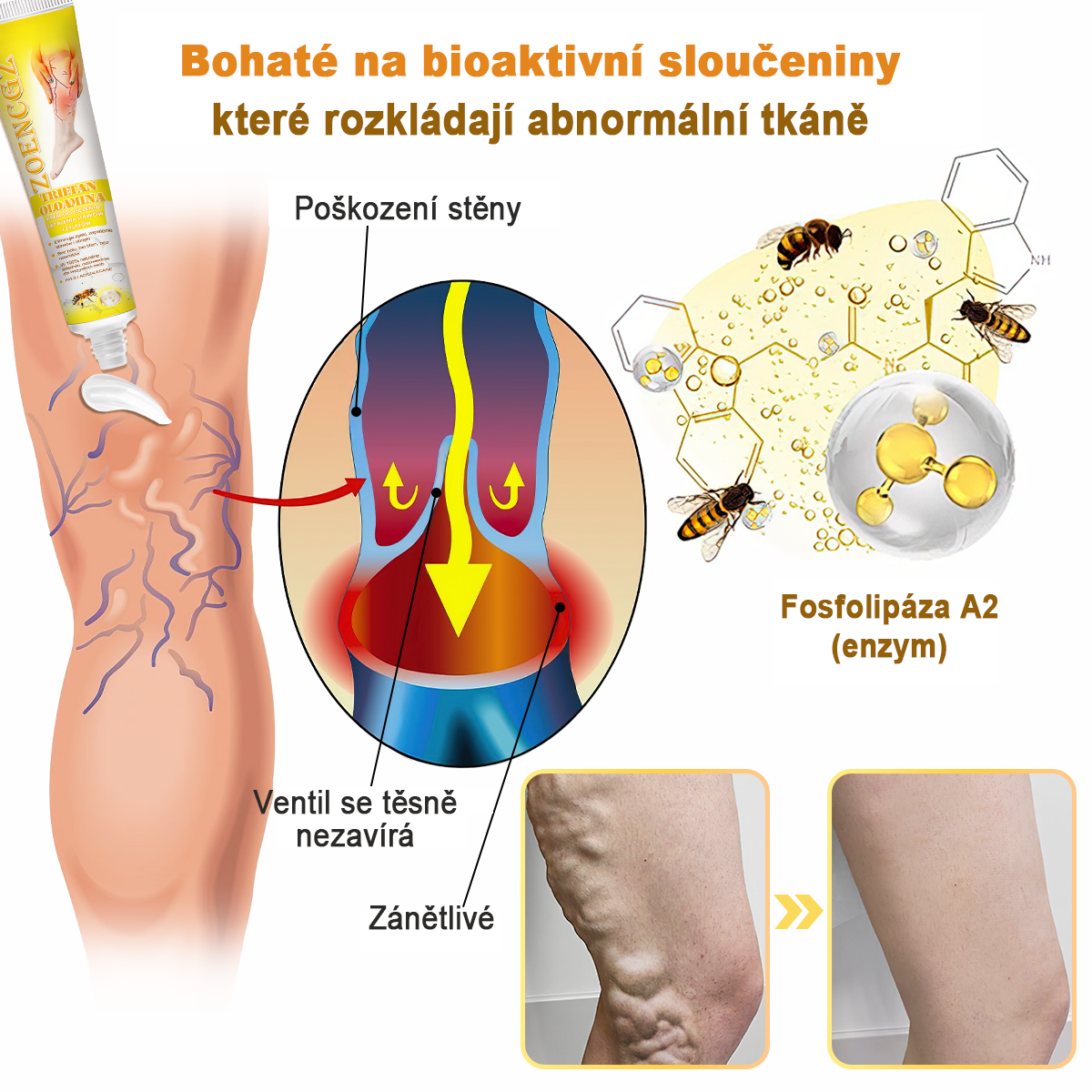 🏆🌈[✨Oficiální značkový obchod✨]Zoencgz™ Krém na léčbu artritidy a křečových žil se včelím jedem（AVLS & ACR DOPORUČUJE）