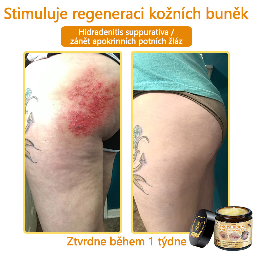 🎇𝐋𝐞𝐧𝐚𝐫𝐨™ Včelí jed všestranný krém, schválený českými dermatology (👩‍ Doporučeno Českou společností pro kožní a pohlavní nemoci CGDV)