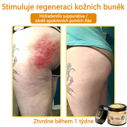🎇𝐋𝐞𝐧𝐚𝐫𝐨™ Včelí jed všestranný krém, schválený českými dermatology (👩‍ Doporučeno Českou společností pro kožní a pohlavní nemoci CGDV)