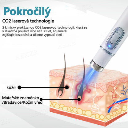 Foulme® PRO Neinvazivní laserové pero na odstraňování bradavic a znamének💥💥