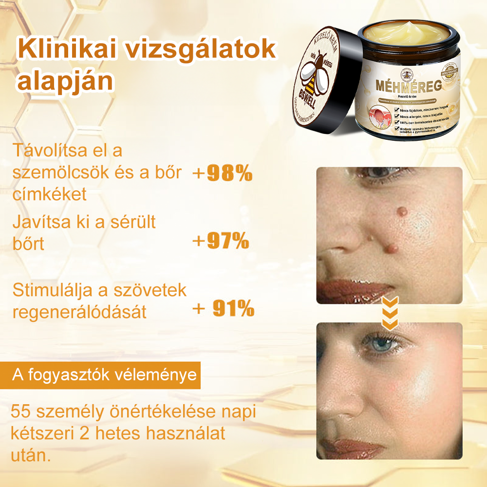🐝BSWELL® Krém na ošetření včelím jedem👨‍⚕️（MDT ajánlott） 🔥poslední den propagace 80% vypnuto