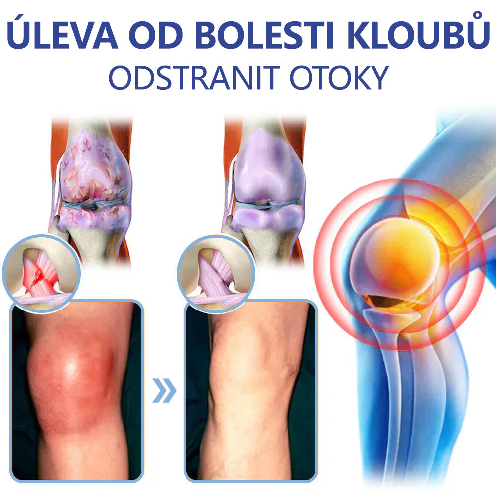 ✅ Schváleno MZČR lékaři | Ourlyard® Hořčíkový krém na úlevu od bolesti kostí a svalů ( Pro artritidu, neuropatii, revmatická onemocnění, svalové křeče, záškuby i sportovní úrazy)