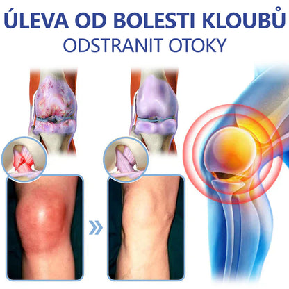 ✅ Schváleno MZČR lékaři | Ourlyard® Hořčíkový krém na úlevu od bolesti kostí a svalů ( Pro artritidu, neuropatii, revmatická onemocnění, svalové křeče, záškuby i sportovní úrazy)