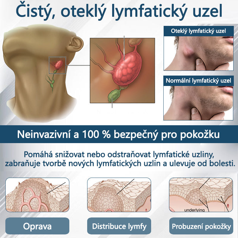 Cvreoz® Černý kmín Edema Detoxikační bylinný krém