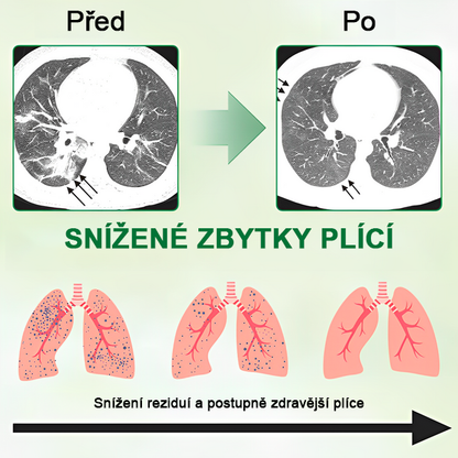 [Oficiální obchod značky] 👨‍⚕️𝐌𝐈𝐐𝐈𝐊𝐎® Pokročilý sprej na čištění plic  (☘️Doporučeno plicními specialisty☘️)