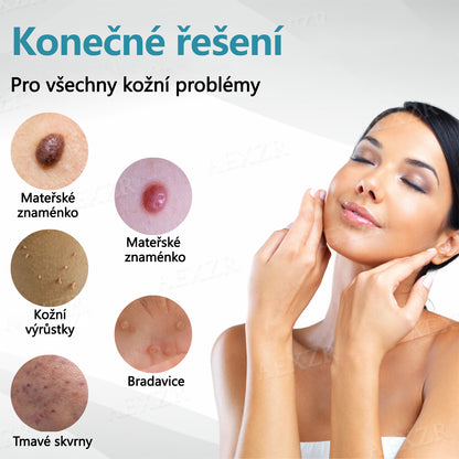 Foulme® PRO Neinvazivní laserové pero na odstraňování bradavic a znamének💥💥