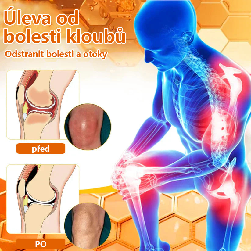 🔥💫Ourlyard™ Hořčíkový olej a včelí jed na hojení kloubů ve spreji👨‍⚕️Cure bolesti kloubů za pouhé 4 týdny, bez zpětného efektu