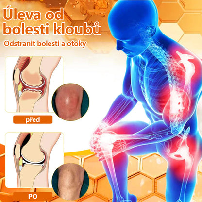 🔥💫Ourlyard™ Hořčíkový olej a včelí jed na hojení kloubů ve spreji👨‍⚕️Cure bolesti kloubů za pouhé 4 týdny, bez zpětného efektu