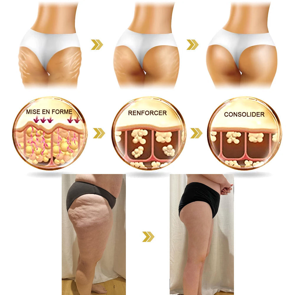 Moondar™ zpevňující krém🍑 : Obnovuje pružnost pokožky 🛍️ Sleva na poslední den: 25% sleva