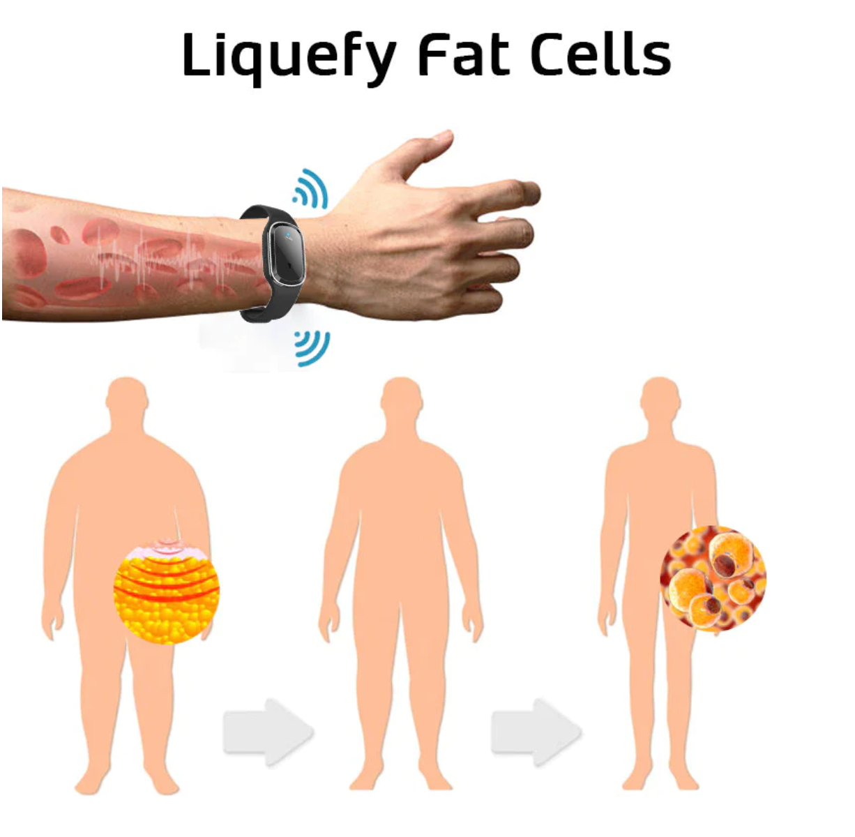 🌱🧑‍⚕️GFOUK™ Ultrazvukové odstraňování tuku a detoxikační náramek(🔥POSLEDNÍ DEN 70% SLEVA)