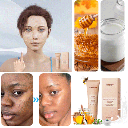 Purifying Exfoliating Gel for Acanthosis Nigricans, Exfoliation, Dark Spots, Skin Tags, and Eczema