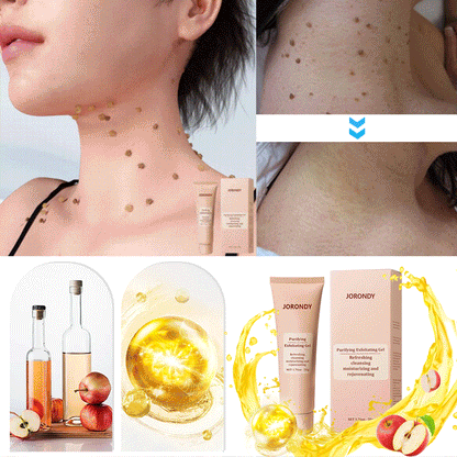 Purifying Exfoliating Gel for Acanthosis Nigricans, Exfoliation, Dark Spots, Skin Tags, and Eczema