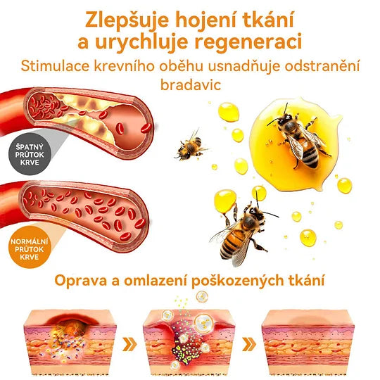 💥🔥𝐕o𝐬𝐨𝐱𝐚™ 𝐕č𝐞𝐥í𝐦 𝐉𝐞𝐝𝐞𝐦 𝐍𝐚 𝐎𝐝𝐬𝐭𝐫𝐚𝐧ě𝐧í 𝐁𝐫𝐚𝐝𝐚𝐯𝐢𝐜 𝐀 𝐙𝐧𝐚𝐦é𝐧𝐞𝐤 𝐊𝐫é𝐦🐝🐝(🔥𝐏𝐫𝐨𝐩𝐚𝐠𝐚č𝐧í 𝐚𝐤𝐜𝐞 𝐧𝐚 𝐩𝐨𝐬𝐥𝐞𝐝𝐧í 𝐝𝐞𝐧 𝟖𝟎% 𝐬𝐥𝐞𝐯𝐚)🔥💥✨