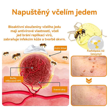 💥🔥𝐕o𝐬𝐨𝐱𝐚™ 𝐕č𝐞𝐥í𝐦 𝐉𝐞𝐝𝐞𝐦 𝐍𝐚 𝐎𝐝𝐬𝐭𝐫𝐚𝐧ě𝐧í 𝐁𝐫𝐚𝐝𝐚𝐯𝐢𝐜 𝐀 𝐙𝐧𝐚𝐦é𝐧𝐞𝐤 𝐊𝐫é𝐦🐝🐝(🔥𝐏𝐫𝐨𝐩𝐚𝐠𝐚č𝐧í 𝐚𝐤𝐜𝐞 𝐧𝐚 𝐩𝐨𝐬𝐥𝐞𝐝𝐧í 𝐝𝐞𝐧 𝟖𝟎% 𝐬𝐥𝐞𝐯𝐚)🔥💥✨